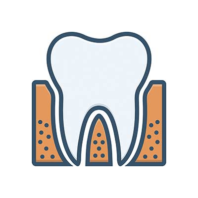 Root Canal in Noblesville, IN